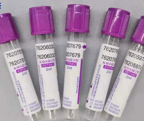 Determination of Fluoride and EDTA in Vacutainer